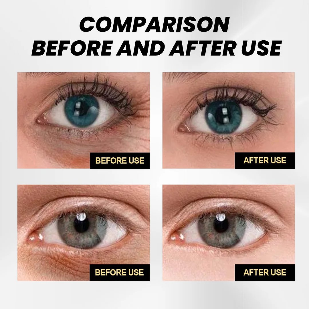 đBuy 1 Get 1 Freeđ - Instant Firming Eye Cream