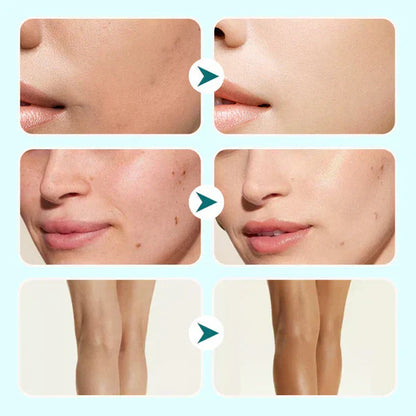 🔥Sista dagen-köp 1 få 1 gratis!🎁Allt-i-ett fuktkräm, concealer och täckning 💧✨ Lätt och vattentät
